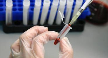 La FDA aprobó Apretude: el primer medicamento inyectable contra el VIH